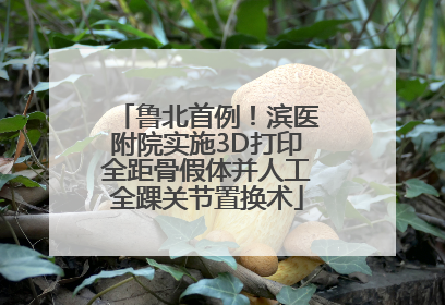 鲁北首例！滨医附院实施3D打印全距骨假体并人工全踝关节置换术